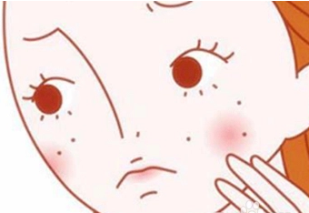 长痘痘了怎么消除 长痘痘可以用洗面奶吗