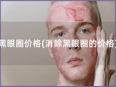 黑眼圈价格(消除黑眼圈的价格)